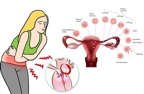 Dysmenorrhea Or Menstrual Pain Healiving