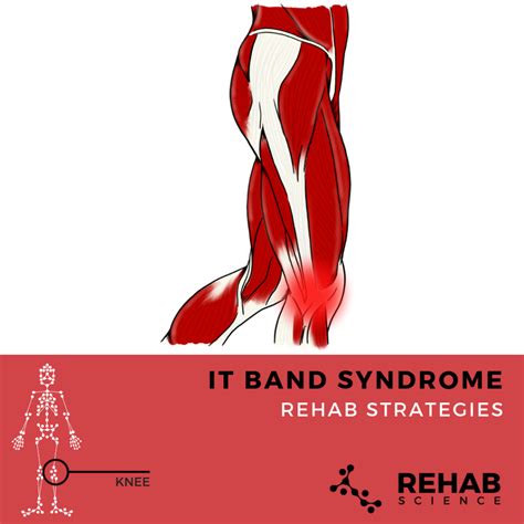 It Band Syndrome Rehab Science