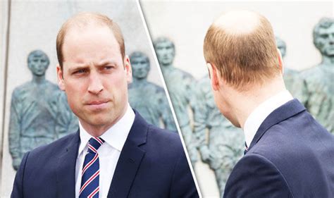 Prince Williams New Hairdo Shows Off His Bald Patch In