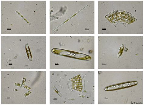 Are Diatoms Protists Comprehensive Facts You Should Know Lambdageeks