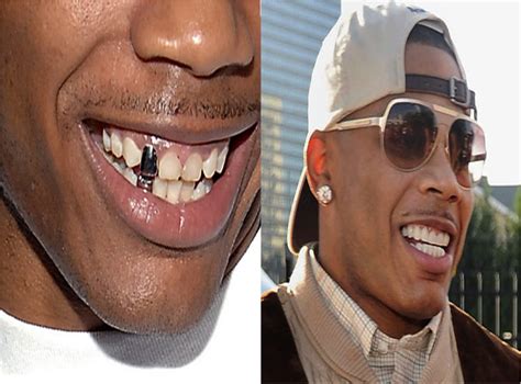 Celebrity Teeth What They Looked Like Before After Madamenoire Celebrity Teeth Teeth