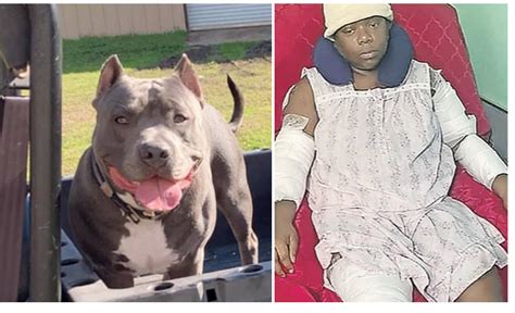 Pit Bull Attacks Cancer Survivor Mauled Baby Dies As Wealthy Animal
