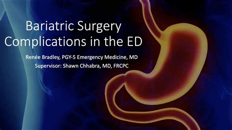 Bariatric Surgery Complications In The Ed Youtube