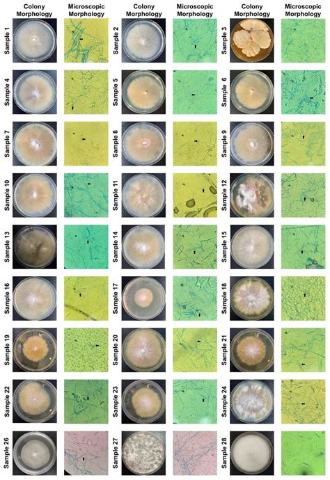 Fungal Cultures And Microscopic Identification Of Clinical Samples All