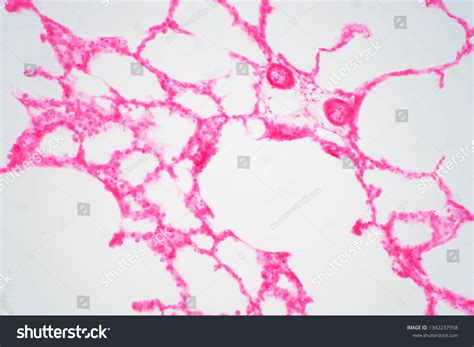 Human Lung Tissue Under Microscope View Stock Photo Edit Now 1342237958