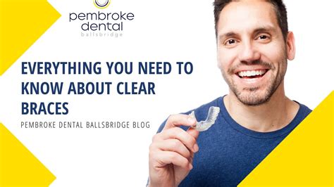 Everything You Need To Know About Clear Braces Pembroke Dental