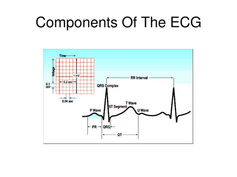 Ppt Electrocardiography Basics Of Interpretation Powerpoint