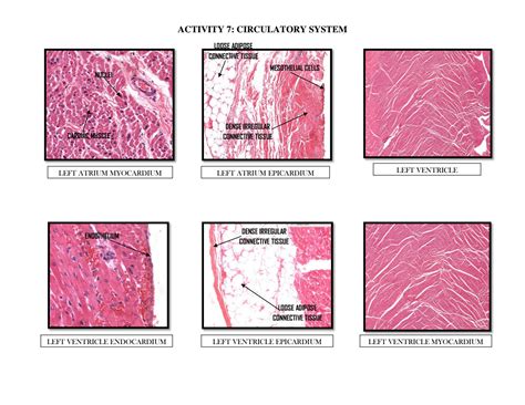 SOLUTION Histopathology Circulatory System Studypool