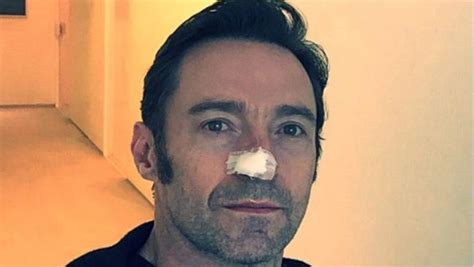 Hugh Jackman Tweets Yet Another Skin Cancer Removed — His Sixth News