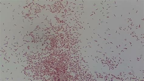 Gram Negative Rods Bacilli Of Pseudomonas Aeruginosa Microscopy Youtube