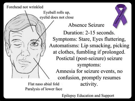Seizure Symptoms Epilepsy Awareness Paralysis Support People Seizures Forehead Resume