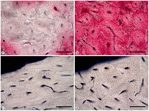 Photomicrographs Of Devitalized Bone Matrix In The Mandible Of
