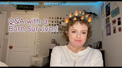Burn Survivor Answers Your Questions Qanda Youtube Burn Survivor