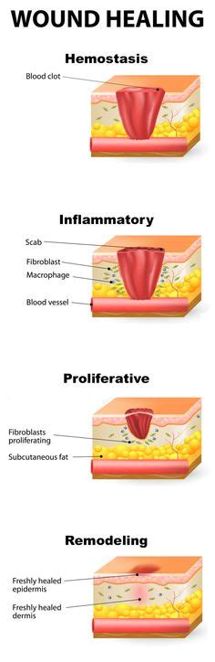 Pin On Wound Care