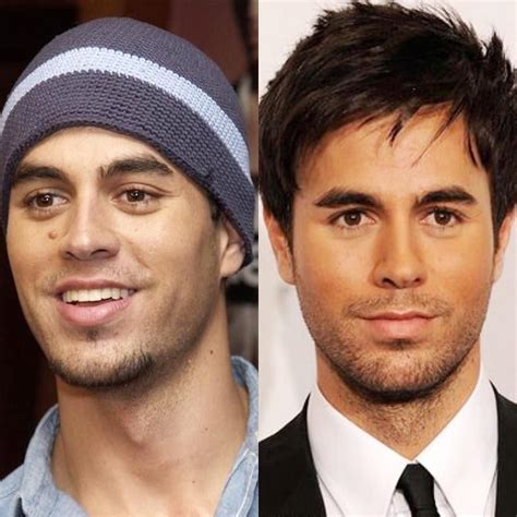 Before And After Of Enrique Iglesias With And Without The Mole Which