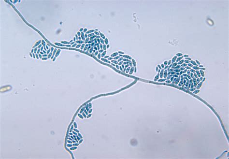 Public Domain Picture This Micrograph Reveals The Mycelia And Conidia