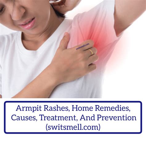 Armpit Rashes Home Remedies Causes Treatment And Prevention Switsmell