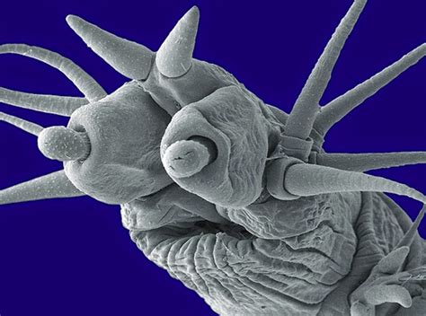 16 Terrifying Images From The Microscope