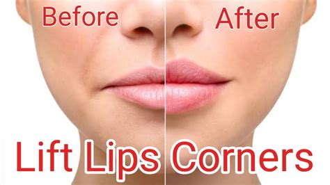 Lip Corner Lift Exercise Lift Lip Corners Naturally Fix Droopy Mouth Corners Youtube