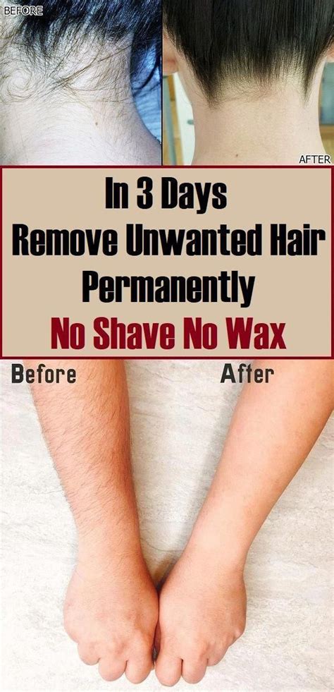 In 3 Days Remove Unwanted Hair Permanently No Shave No Wax In 2022
