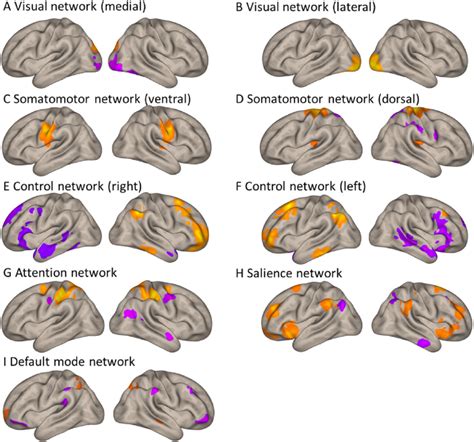 Large Scale Brain Networks Identified In The Independent Component Download Scientific Diagram