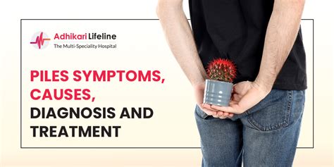 Piles Symptoms Causes Diagnosis And Treatment