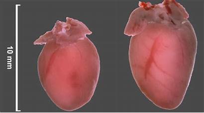 Mice Hypertrophy Heart Cardiac Mouse Failure Cardiovascular