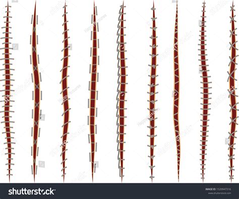 Set Different Illustrations Medical Stitches Injury Stock Vector