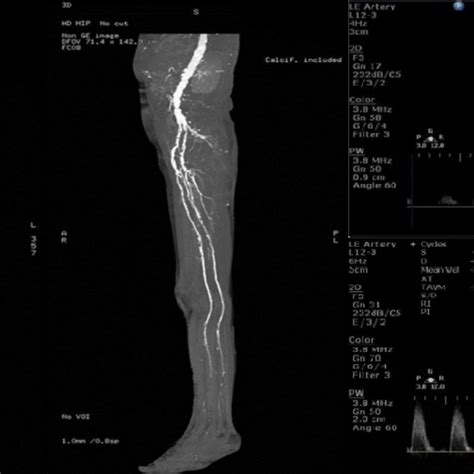 Vascular Imaging Ct Angiography And Doppler Ultrasound Nia Diagnostic