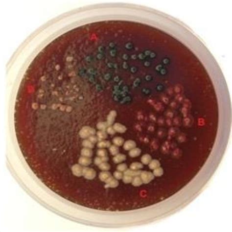 Distribution And Identification Of Candida Species Using Multiplex Pcr