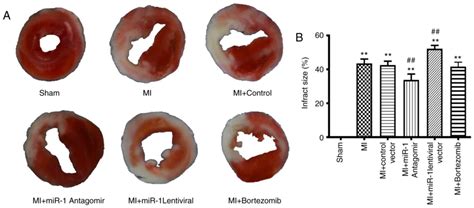 Ubiquitin‑proteasomes Are The Dominant Mediators Of The Regulatory