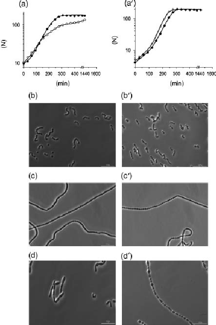 Growth Of Streptococcus Oralis Strains With And Without Choline Ad