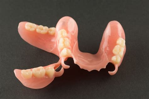 Removable Partial Denture Upper