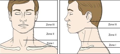 Zones Of The Neck