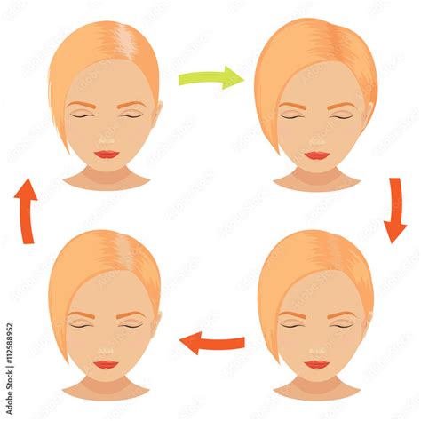 Female Hair Loss Stages Set Blond Woman Before And After Hair