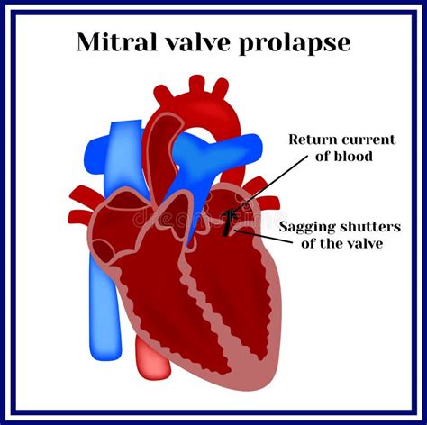 Human Heart Mitral Valve