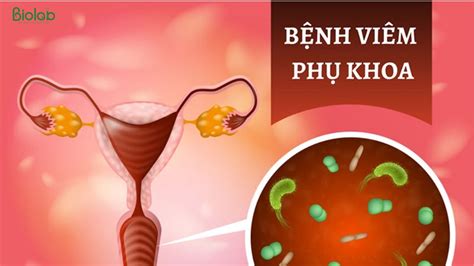 Tổng Hợp 5 Bệnh Phụ Khoa Thường Gặp Nhất ở Phụ Nữ