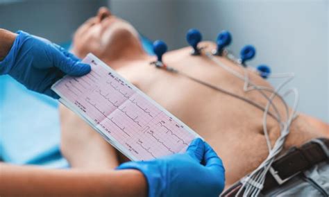 EKG Czym Jest Elektrokardiogram Jakie Wskazania Do Wykonania