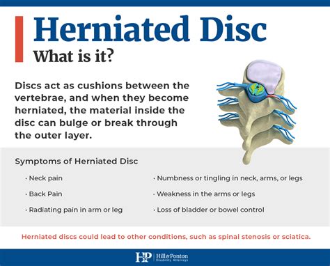 Disability Rating Cervical Disc Herniation