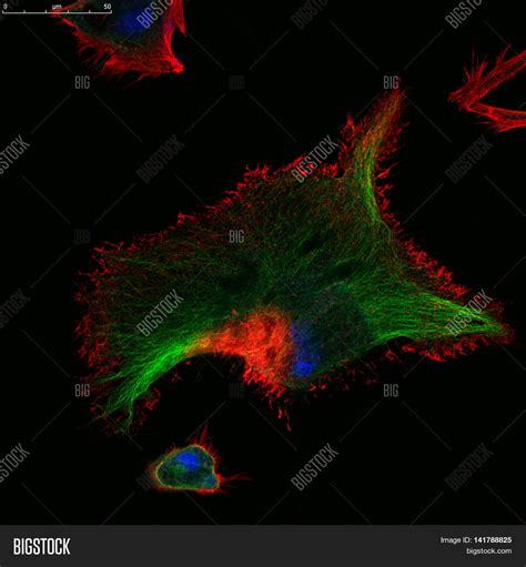 Confocal Microscopy Of Fibroblast Cells Image And Stock Photo 141788825