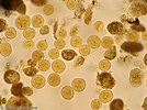 Entamoeba coli Cysts in feces | Medical Laboratories