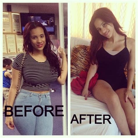 Erica Mena Plastic Surgery Before And After Her Boob Job My XXX Hot Girl