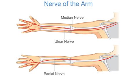Radial Tunnel Syndrome Melbourne Hand Therapy