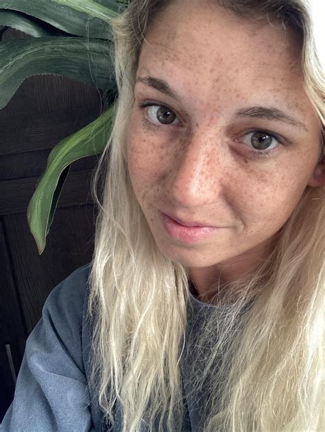 No Filter No Makeup Full Of Freckles Scrolller