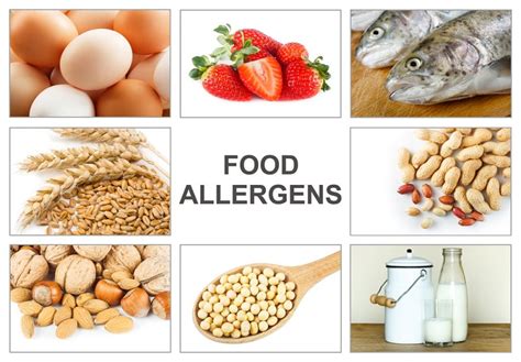 What Are The 8 Most Common Food Allergies Food Allergies Atlanta