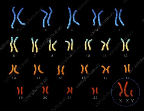 Klinefelters Syndrome Karyotype Illustration Stock Image C055