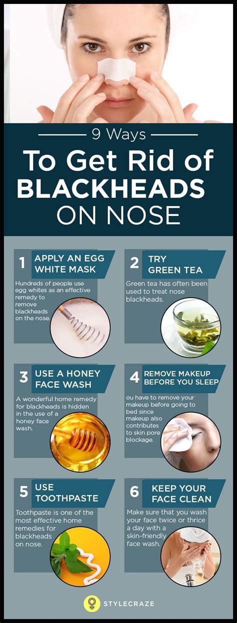 How To Get Rid Of Blackheads Easy At Home Howtoeromv