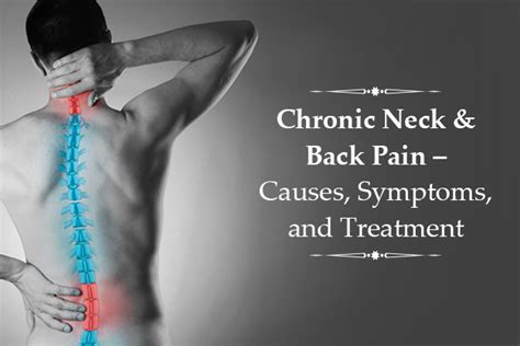 What Causes Back Neck Pain How Back Neck Pain Center Can Help