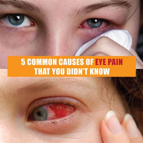 Eye Pain Causes And Treatment Stephi Lareine Riset