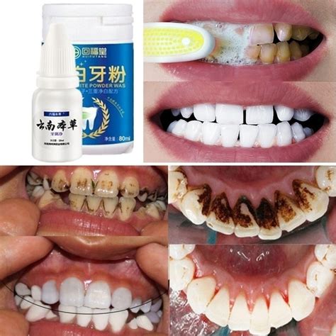 1 Bottle 1080ml Magic Natural Teeth Whitening Mouth Cleaning Oral